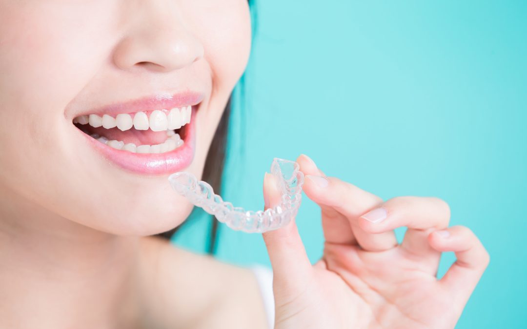 Why Should You Opt for Invisalign Over Other Invisible Aligners?