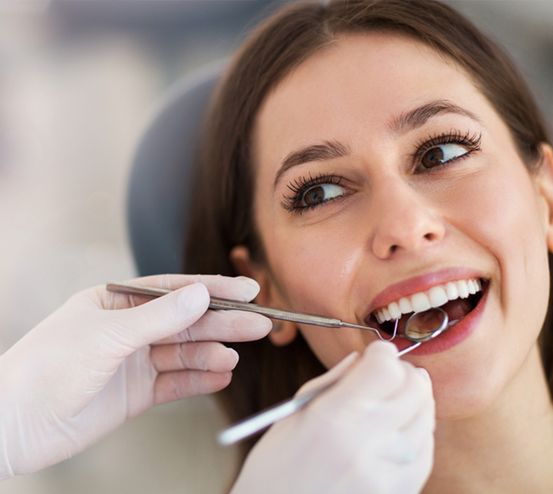 dental inlays and onlays in barrie