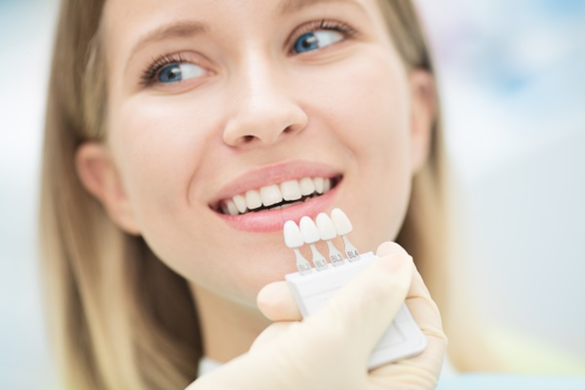 dental veneers in barrie