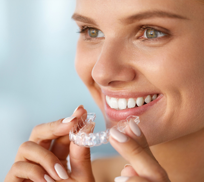 Invisalign in Barrie, Orthodontic Treatment in Barrie